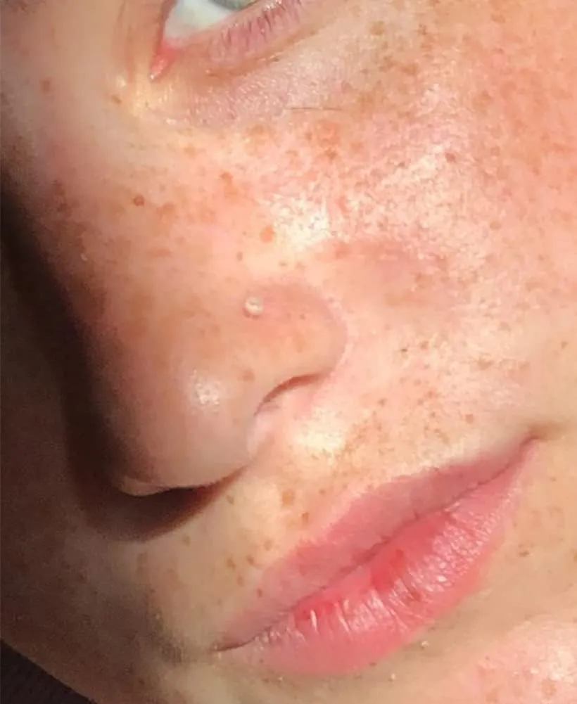 Longita Clear Nose Studs Clear Nose Rings for Work Clear Nose Piercing Plastics Nose Retainer for Surgery Nose Ring Spacers Nose Rings Retainer Septum Retainer Clear Lip Rings Plastic Earrings Studs